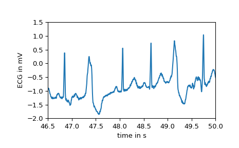 ../../_images/scipy-datasets-electrocardiogram-1_01_00.png