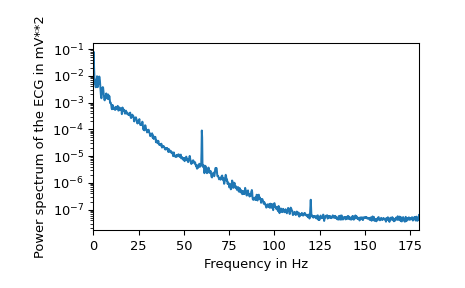 ../../_images/scipy-datasets-electrocardiogram-1_03_00.png